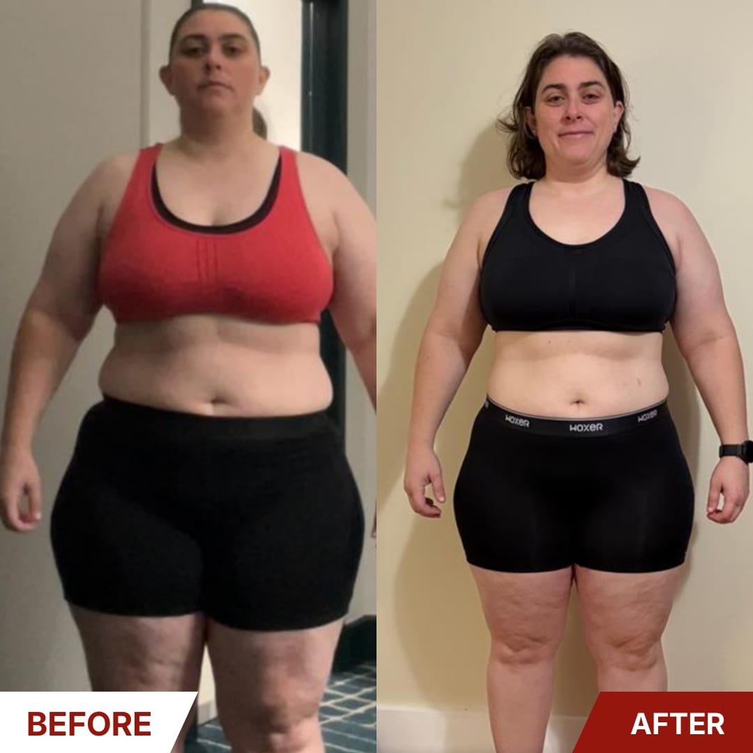 Client front view before and after