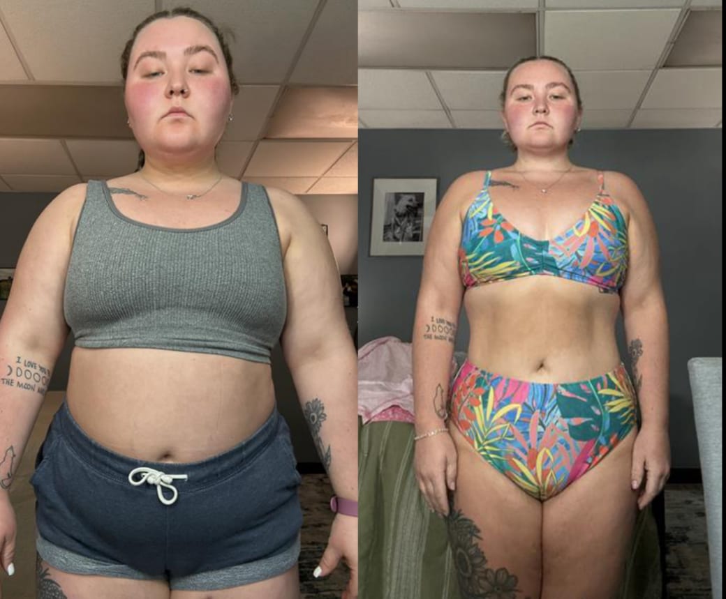 Devyn before and after, 100 lbs down